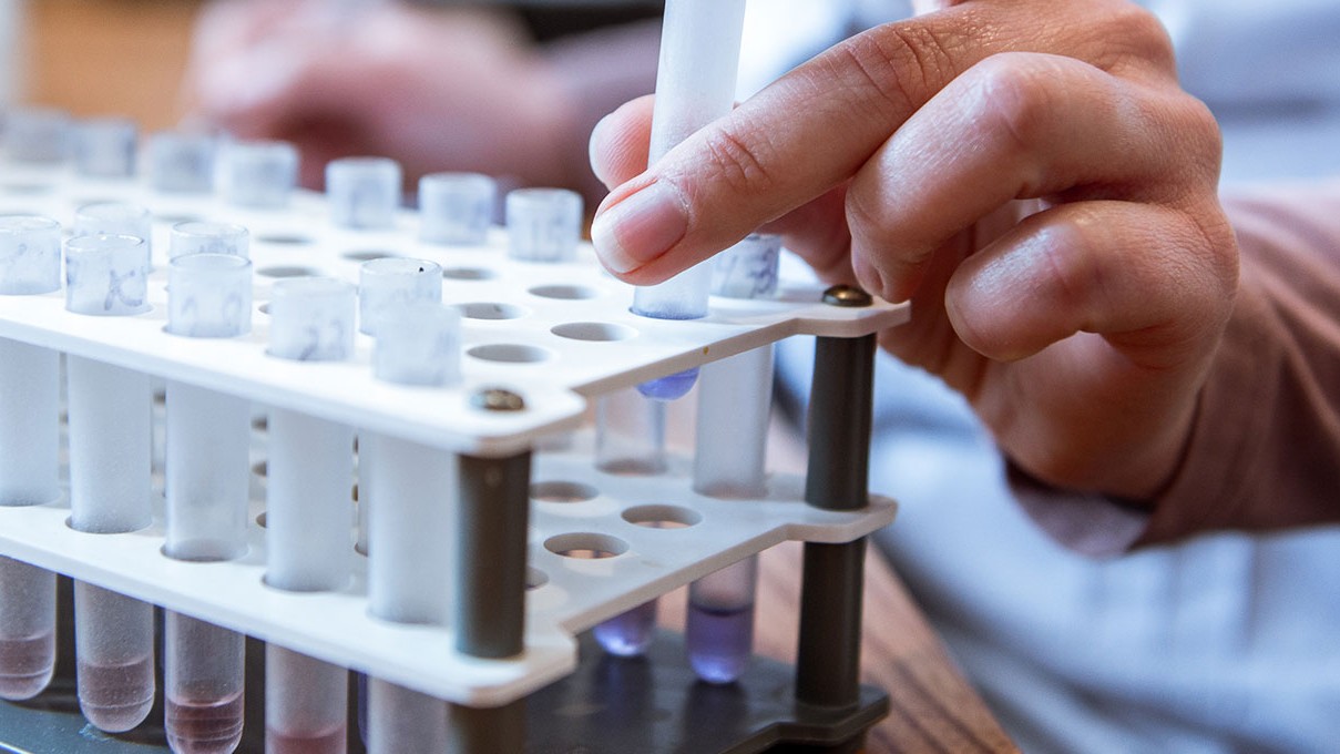 clinician holding test tube