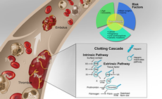 Venous Thromboembolic